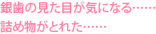 銀歯の見た目が気になる……詰め物がとれた……